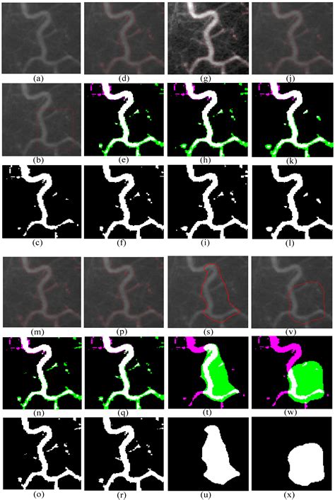 A New Active Contour Medical Image Segmentation Method Based on ...
