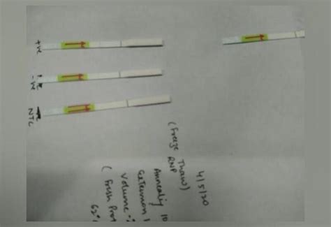 India's 1st CRISPR COVID-19 test 'FELUDA' approved for use