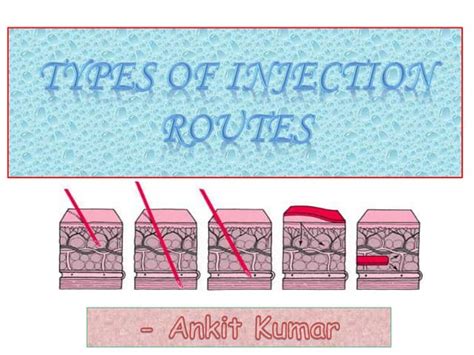 Injection Types 的图像结果