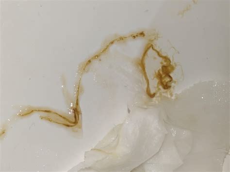 Constant bloating and mucus ropes in stool : r/Longcovidgutdysbiosis