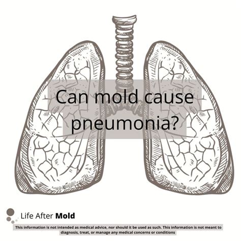 yeast pneumonia