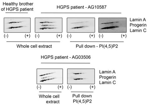 Lamin A/C and PI(4,5)P2—A Novel Complex in the Cell Nucleus
