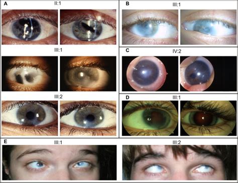 Image result for Iris Recognition Using MATLAB Source Code