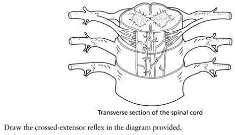 Image result for Crossed Extensor Reflex Demonstration