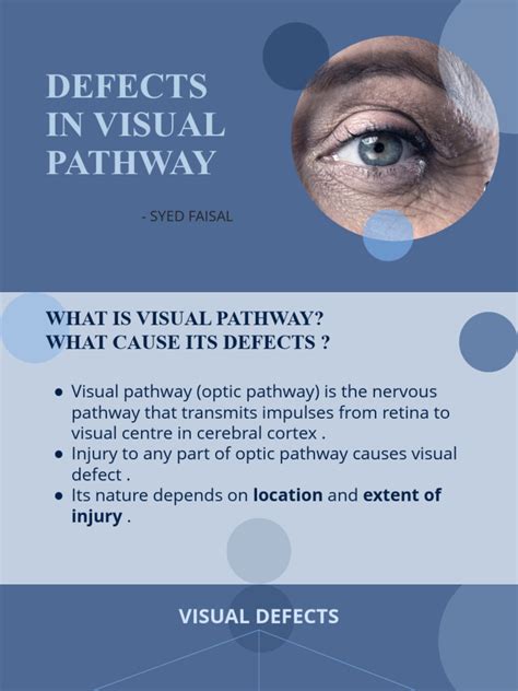 Image result for Visual Pathway Defects