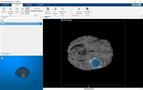 Image result for Volume Segmenter MATLAB Tutorial