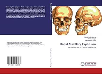 Rapid Maxillary Expansion : Amazon.in: Books