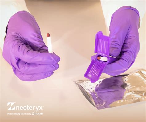 Image result for Micro Sampling