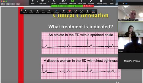Telemetry Class 的图像结果