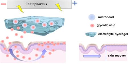 Gels | Special Issue : Advances in Functional and Intelligent Hydrogels