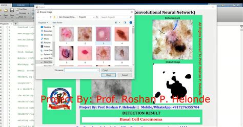 Image result for Skin Disease Detection Using MATLAB