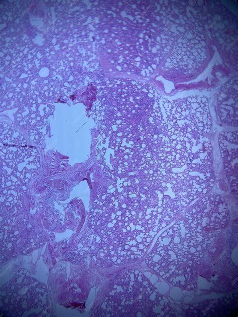 Lung tissue histology isolated | Premium Photo