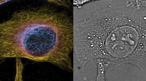 Image result for Super-Resolution Microscopy