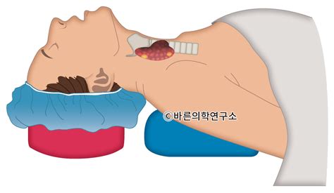 Image result for Retainer Clips Ice Machine