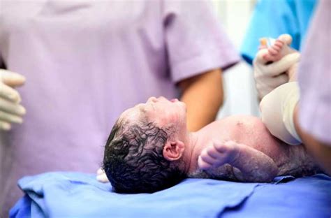 Image result for Que Significa Apgar