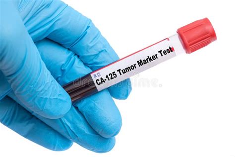 CA-125 blood test, Purpose and results interpretations