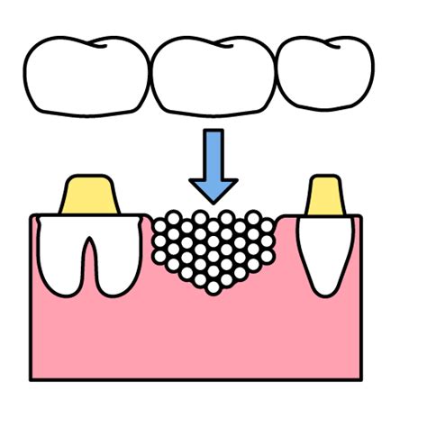 Image result for Tooth Mobility Problem