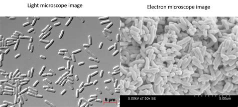 Microscope Bacteria 的图像结果