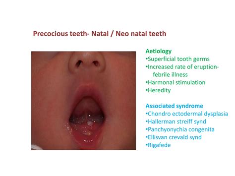 developmentofocclusion-240405053041-6ac893f8.pptx