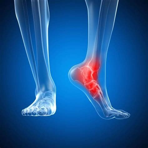 Foot Pain: Causes, Symptoms, and Effective Treatment