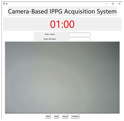 Deep Learning-Based Non-Contact IPPG Signal Blood Pressure Measurement ...