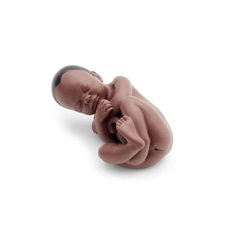 Pregnancy Pelvis Model in Median Section with Removable Fetus (40 weeks ...