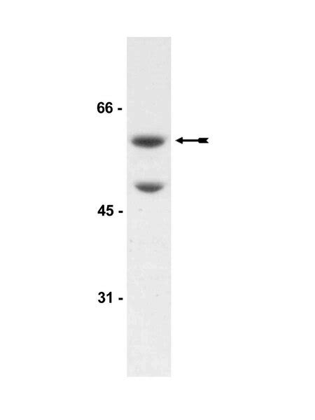 Anti-Akt3/PKBγ Antibody | 07-383