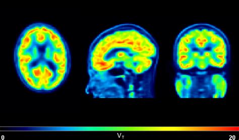 Image result for Pmod Software