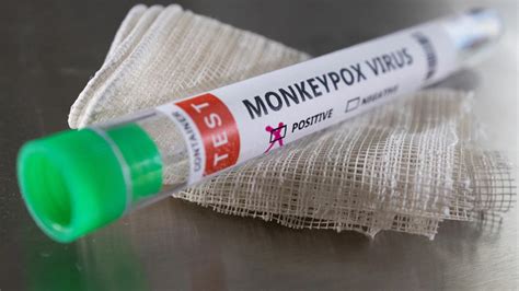 30 children found America infected monkeypox virus spread 50 states ...