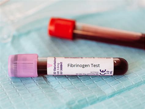 Image result for Fibrinogen Test Procedure
