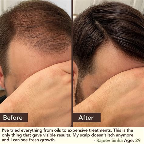 About Bhringraj – THE LIVING CO.