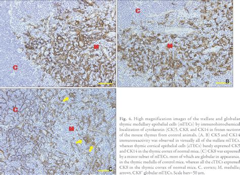 Image result for What Is Thymic Involution