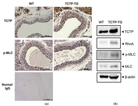 Up-Regulation of Rhoa/Rho Kinase Pathway by Translationally Controlled ...