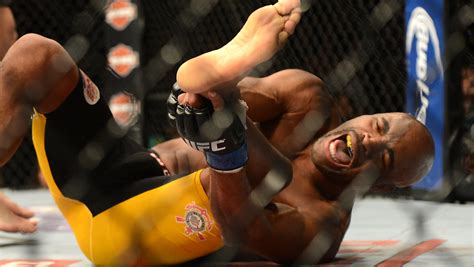 Anderson Silva Broken Leg X Ray