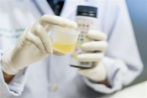 Can A UTI Go Away On Its Own? - ELMENS