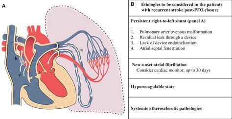 Atrial Fibrillation 的图像结果