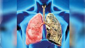 Black Lung Disease | ब्लॅक लंग्ज डिसिजच्या अंतरंगात