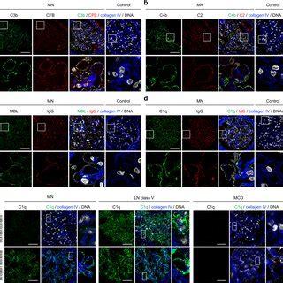 Image result for Complement Activation