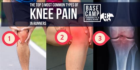 DO YOU KNOW the 3 MOST COMMON types of Knee Pain in Runners? — Base ...