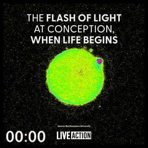Image result for Conception Light Flash