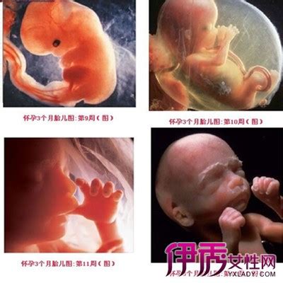 三个月胎儿多大了图,3个月胎儿引产下来图 - 伤感说说吧