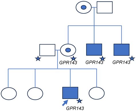 GPR143-Associated Ocular Albinism in a Hispanic Family and Review of ...
