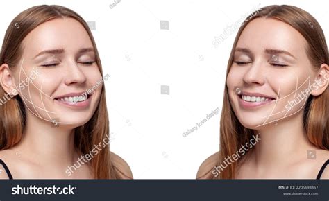 Image result for Cheekbones Reduction Book