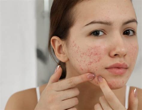 Image result for Example Health