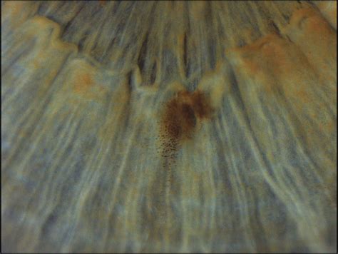 ZEISS SL Imaging Solution | ZEISS Medical Technology