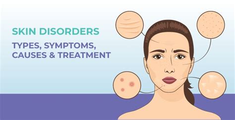Skin Disorders - Types, Symptoms, Causes & Treatment | MrMed