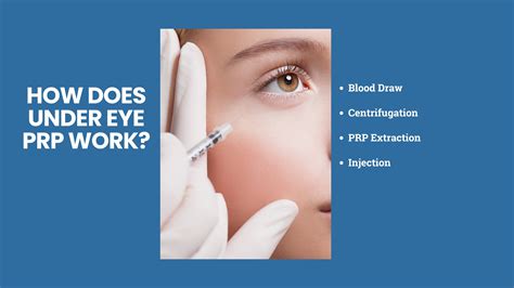 Under Eye PRP Before and After