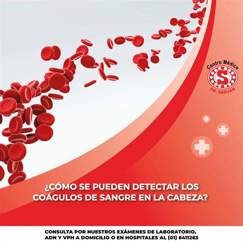 Coágulos De Sangre Y Cómo Evitar La Coagulación Sanguínea Anormal – PWPK