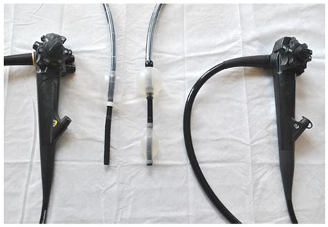 Balloon-Assisted Colonoscopy after Incomplete Conventional Colonoscopy ...