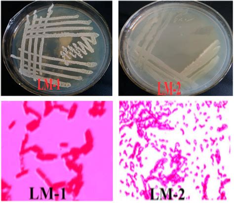 IJERPH | Special Issue : Microorganisms in the Environment